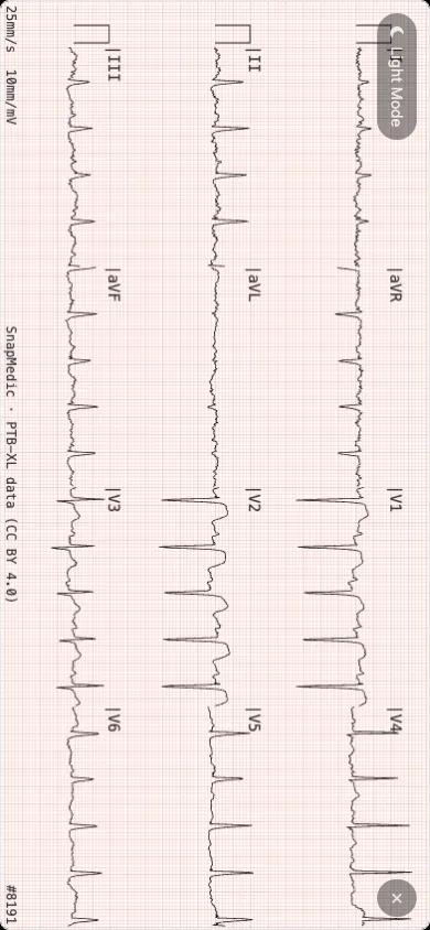 Full screen 12-lead ECG view