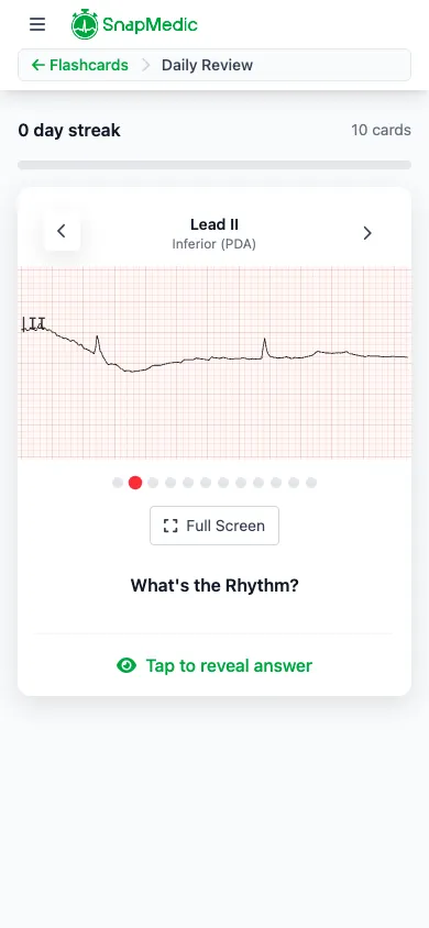 ECG flashcard showing rhythm recognition quiz