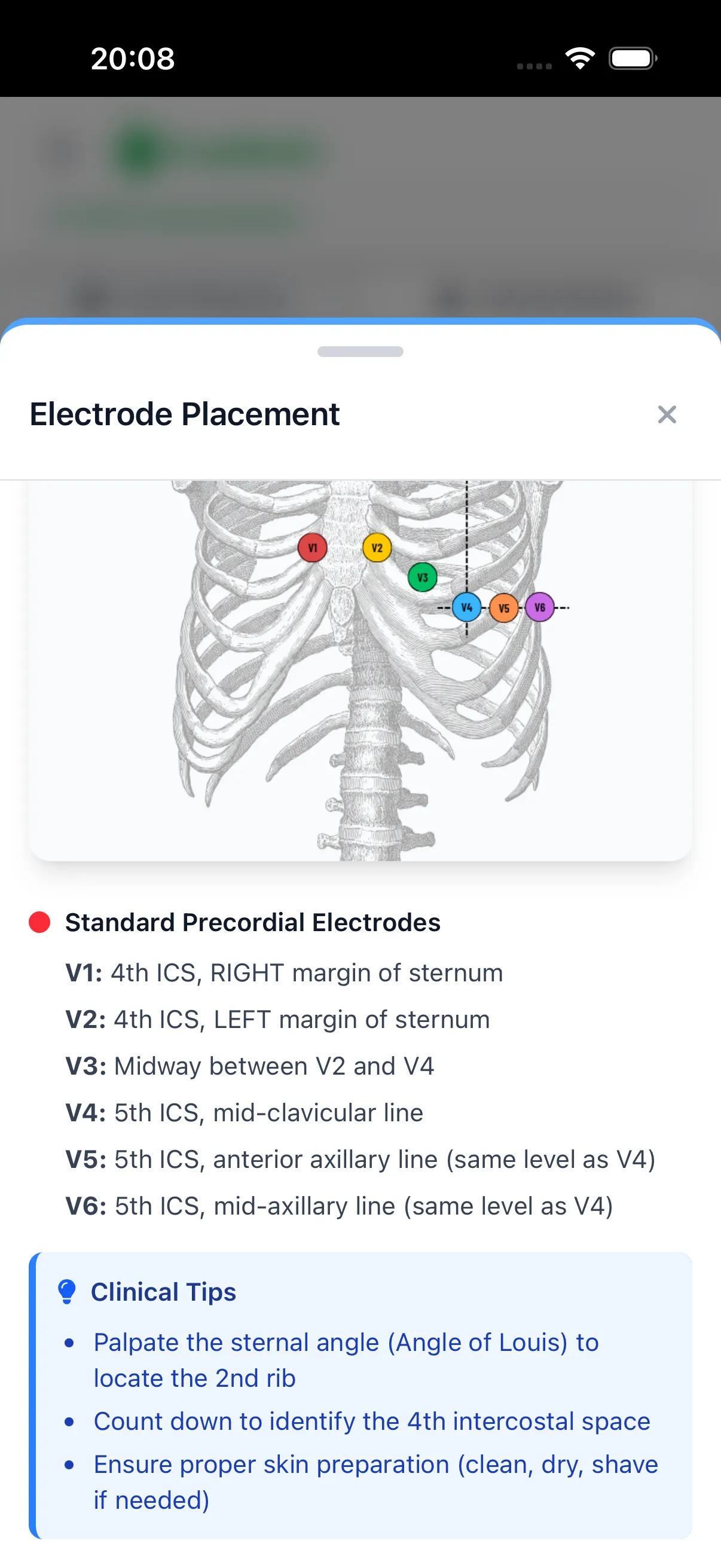 Electrode Placement Guide
