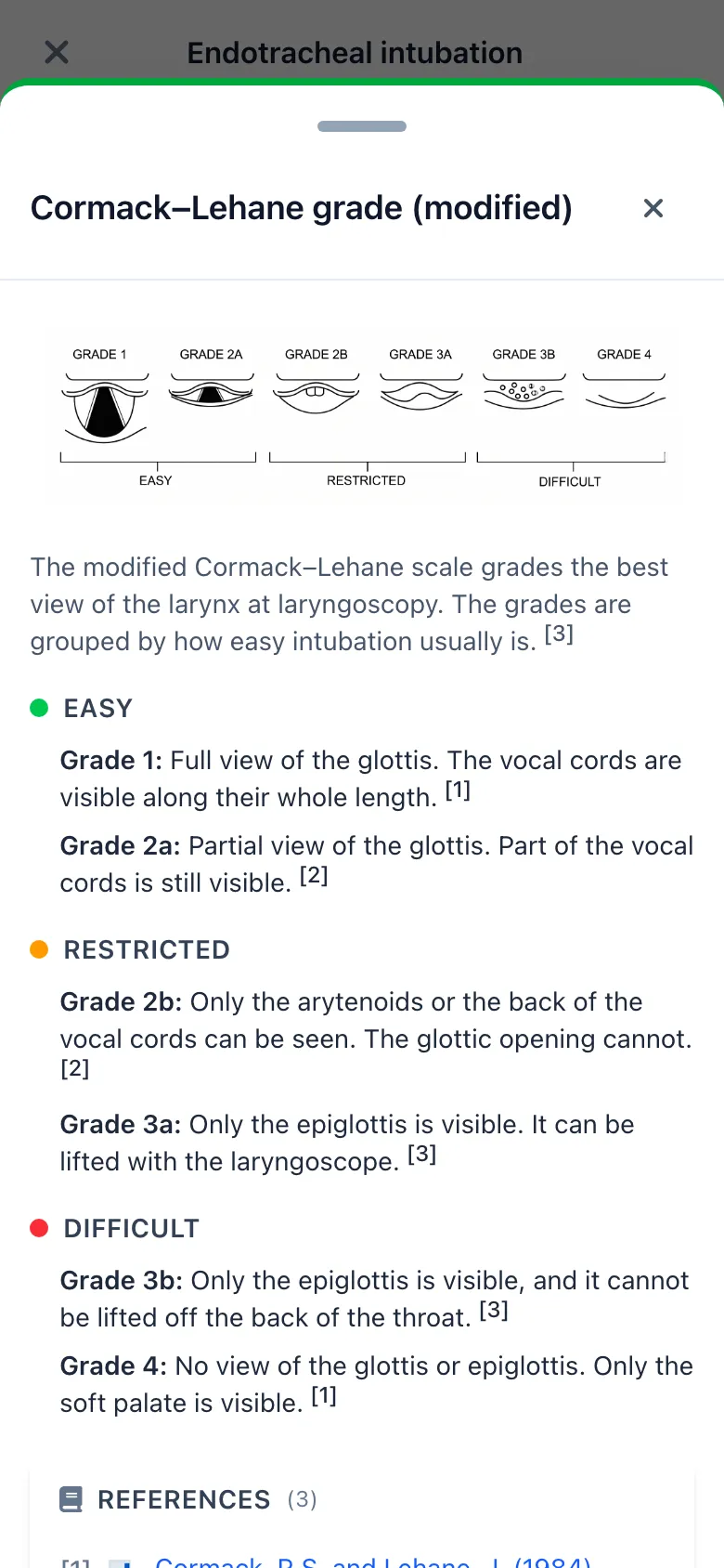 SnapMedic Cormack-Lehane help drawer showing the grade diagram and referenced descriptions